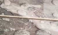 头疼！美缝又“白白”了！
